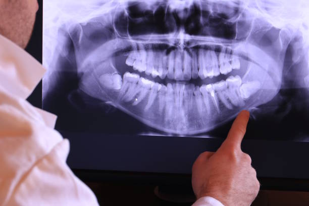 Best Urgent Dental Care for Toothaches in Hartshorne, OK